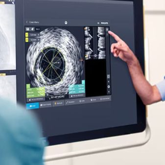 NE India now has access to HD-IVUS, rotablation techniques