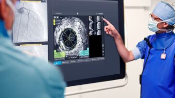 NE India now has access to HD-IVUS, rotablation techniques